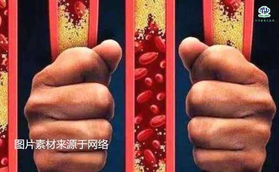 不想給血管“添堵”，盡量少吃以下這些東西，或許能讓腦梗離遠些  